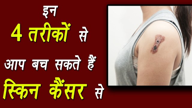 4 ways to prevent skin cancer | स्किन कैंसर से बचने के ये 4 घरेलू उपाय | Boldsky