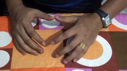 Pinles (Hemorrhoids) leave in just ten days - सिर्फ दस दिन में बवासीर की छुट्टी