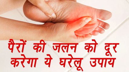 Inflammation in legs, पैरों में जलन | Home Remedy | पैरों की जलन को दूर करेगा ये घरेलू उपाय| Boldsky