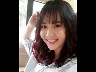 phẫu thuật căng da mặt nội soi