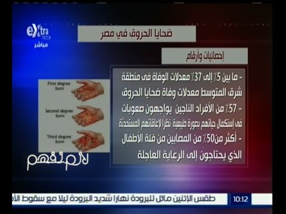 لازم نفهم | إنفوجرافيك | ضحايا الحروق في مصر