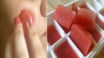 Tomato Lemon Ice cubes for Skin whitening, Pimples,dark spots, blemish, suntan, Acne