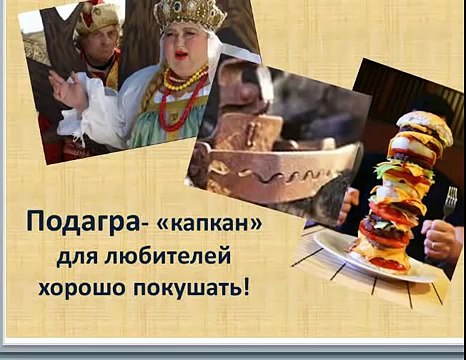 Подагра симптомы. Подагра лечение народными средствами. Подагра признаки