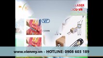 Máy laser trẻ hóa âm đạo CICU VR - Công ty Viên Mỹ giới thiệu