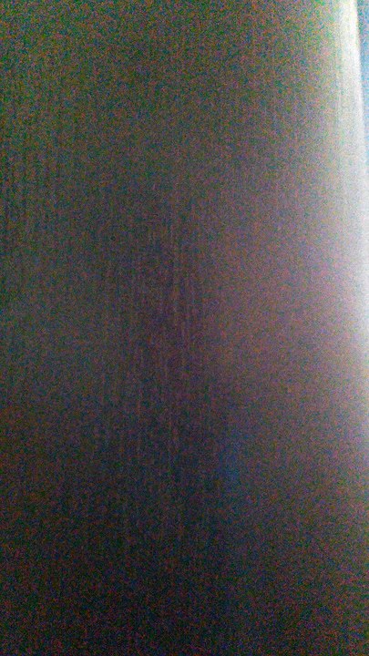 Je Suis Malade Serge Lama Par Daniel Jean