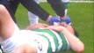 Kieran Tierney Gets His Tooth Knocked Out vs Aberdeen!