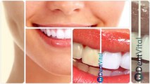 DentVital Klinik | İmplant Diş Tedavisi; Diş İmplantı, Zirkonyum, Lamina, Empress diş uygulamaları