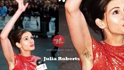 11 Famosas sin depilarse