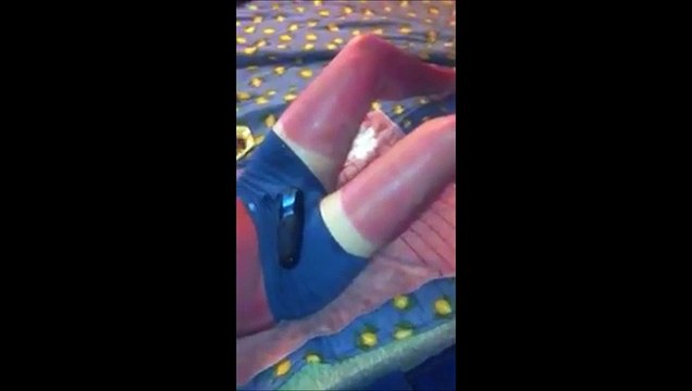 Il s'endort au soleil et prend un coup de soleil enorme et douloureux !