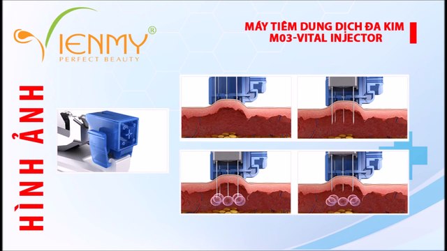 Liệu trình trị nám và tàn nhang cùng dung dịch tiêm Rouicee The Red và Máy Vital Injector