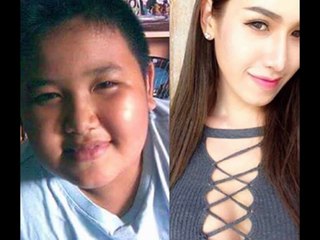 Dịch vụ nhấn mí hàn quốc đẹp