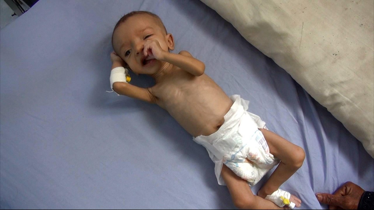 Millions of Yemenis starving in Ramadan