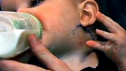 Bebé se Rascaba el Cuello, Pero Luego salio algo muy Extraño!