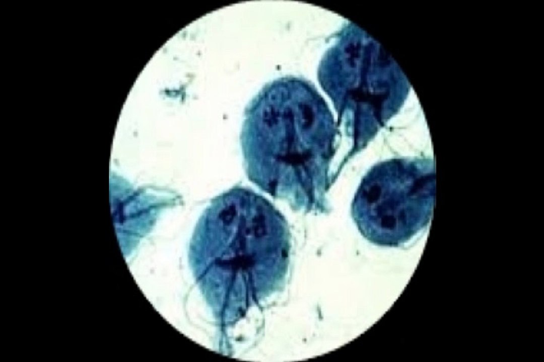 trofozoíto Giardia lamblia