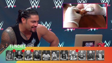 Stars Try Not To Flinch Challenge