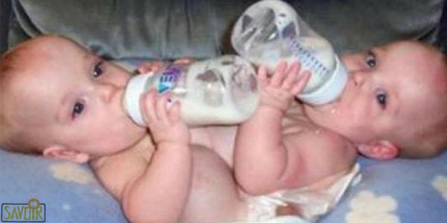 Ces deux jumelles sont nées collés l'une à l'autre. mais regardez ce qu'elles sont devenues aujourd'hui!