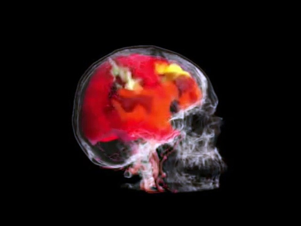 Le cerveau d'une femme qui a un orgasme