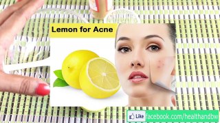 How to get rid of pimple in teenage   Best pimple clearing method overnight (Secret Revealed)