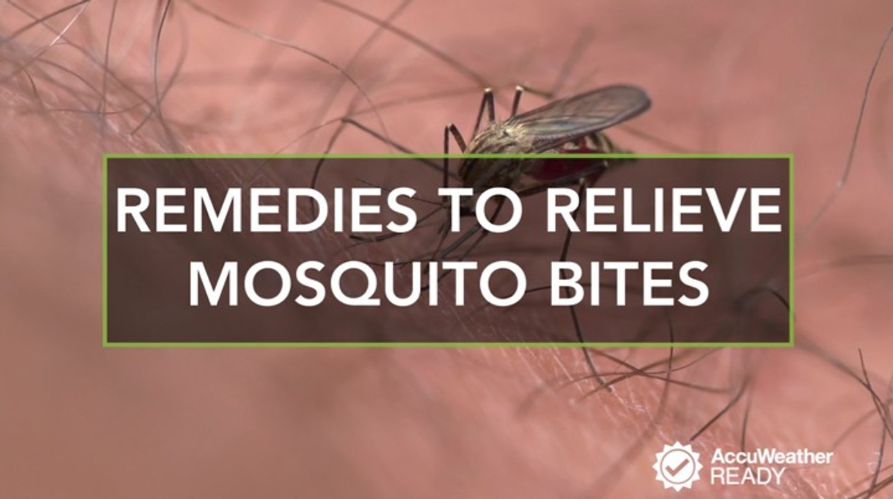 Best home remedies to relieve itchy mosquito bites
