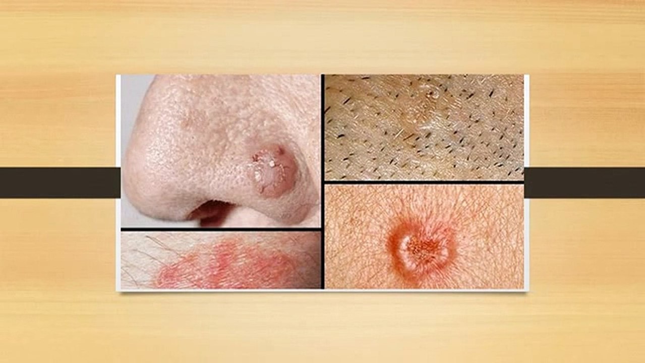 attention, si vous voyez ces signes, c'est le cancer probablement