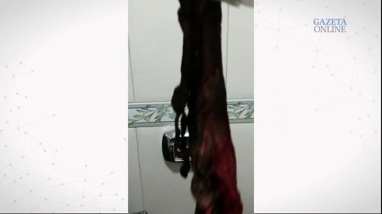 Mulher faz parto normal e encontra gaze dias depois