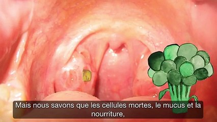 1 personne sur 4 souffre de ce problème qui donne mauvaise haleine