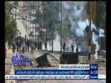 #غرفة_الأخبار | إصابة أكثر من 100 فلسطيني في مواجهات معقوات الاحتلال الإسرائيلي