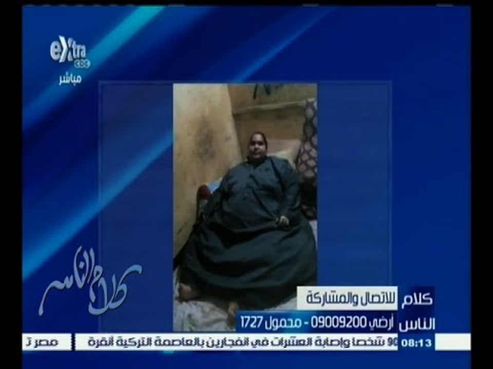 #كلام_الناس | شخص يعاني من البدانة المفرطة يطلب بتدخل الرئيس السيسي لحل مشكلته بعد تقصير المستشفيات