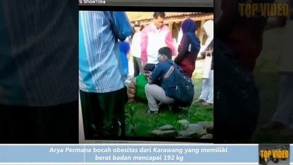 09.Mengejutkan, Ingat Arya Permana Bocah Obesitas, Setelah Operasi Bariatrik Kini Tambah Langsing