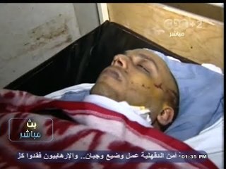 #بث_مباشر | تقرير عن المصابين في حادث #المنصورة الإرهابي