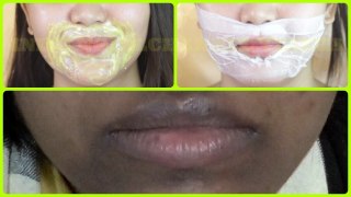 How To Get Rid Of dark black patches, dark spots ,Hyper pigmentation, around your mouth