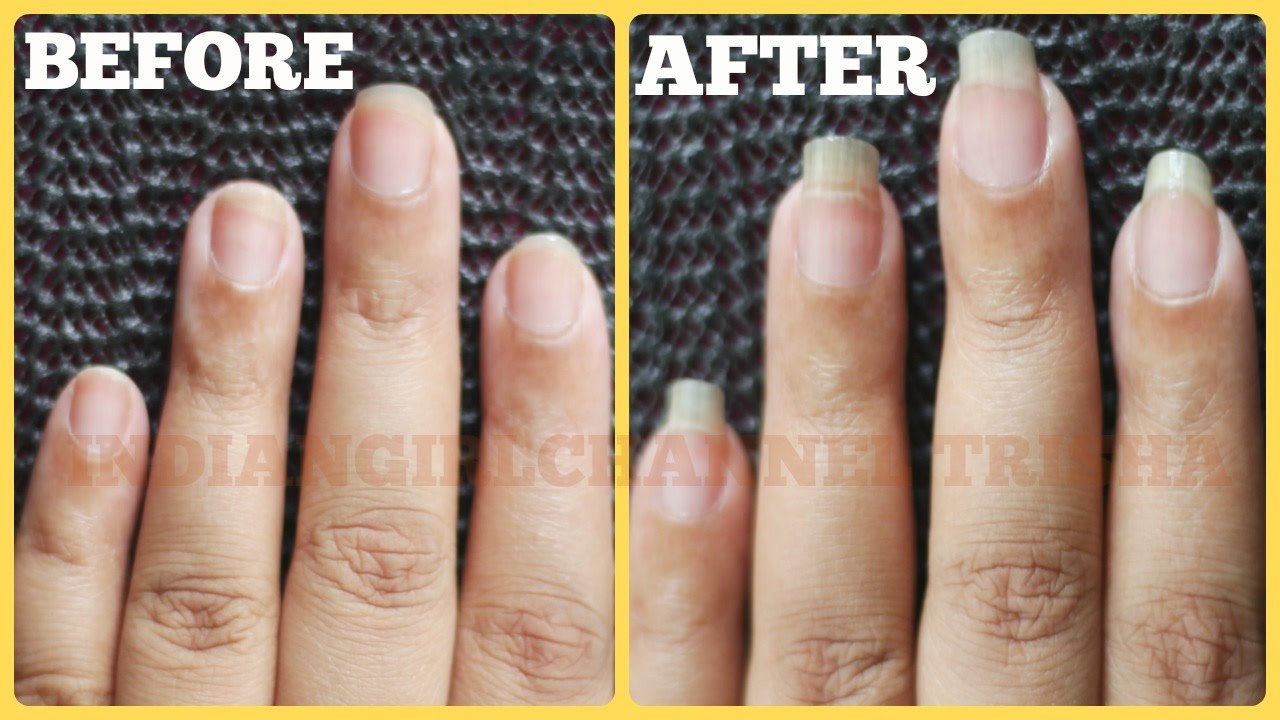 how to grow nails fast, long and strong-nail growth treatment-long nails tips