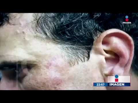 Policía lastima a opositor de Nicolás Maduro | Noticias con Ciro Gómez Leyva