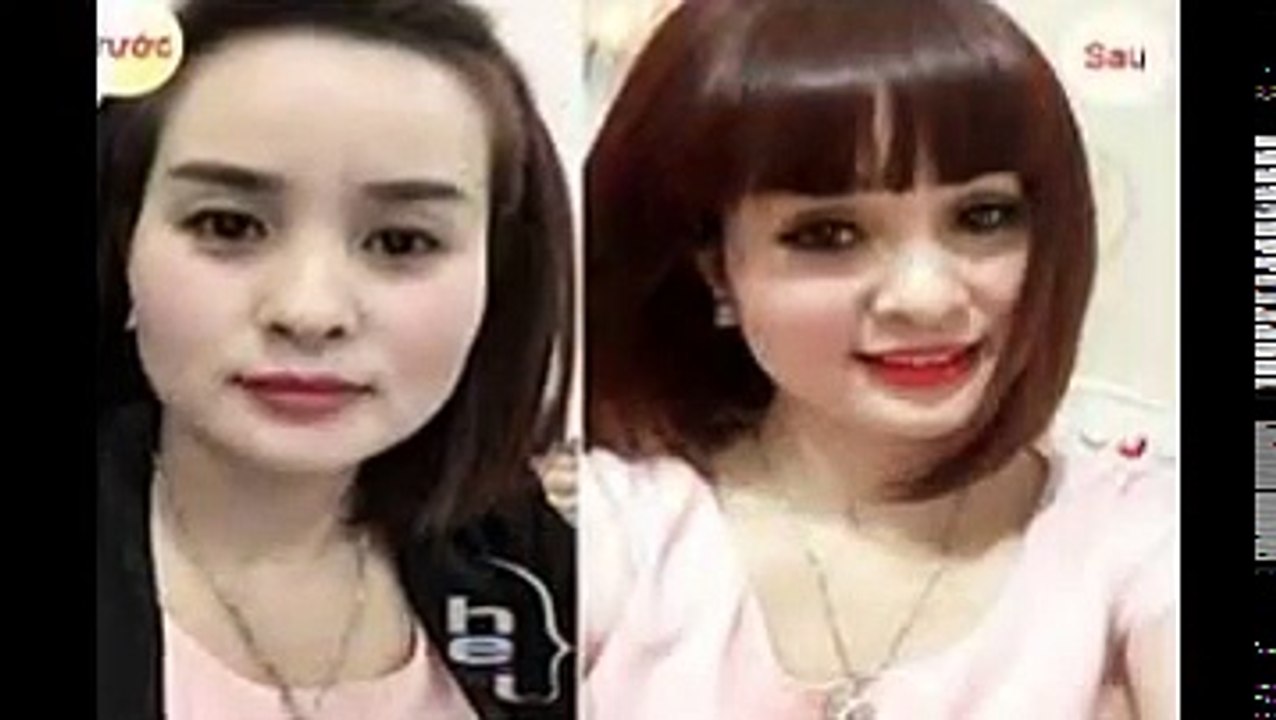 Bấm mí Hàn Quốc công nghệ chăm sóc sắc đẹp tiên tiến