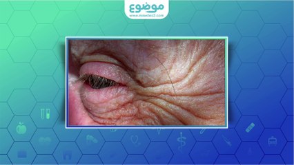 تأثير العمر على الجلد