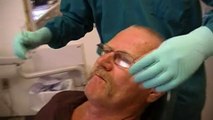 Partial Denture with Implants Placed by Josh Brower Dentist