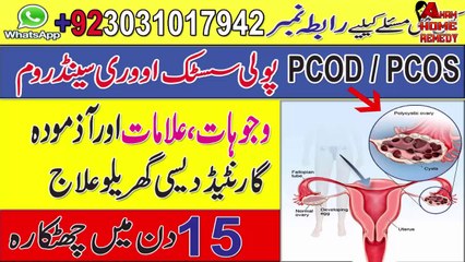 PCOS Causes And Treatement Home Remedy To Cure Ploycystic Ovary Syndrome