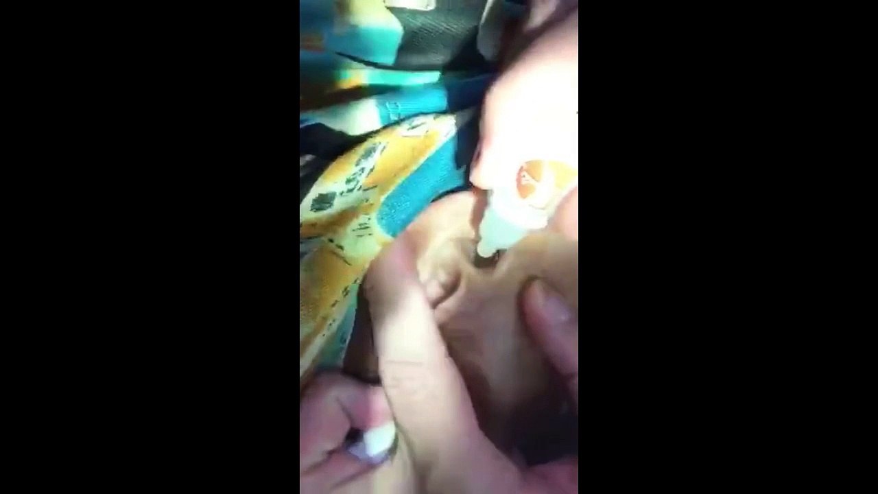 EAR 256