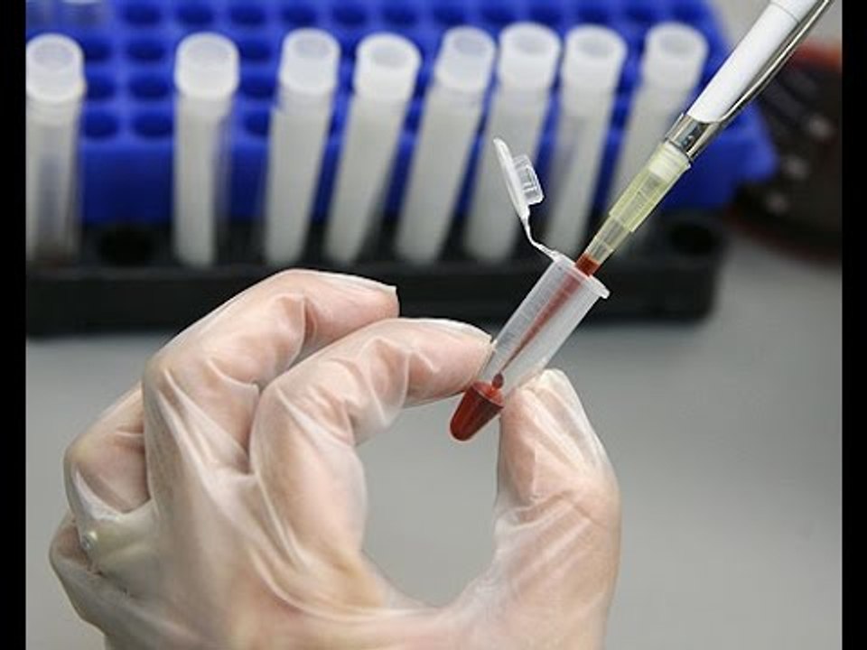 La importacia de realizarse la prueba del antígeno prostático