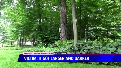 Michigan Man Claims He Was Bitten by Deadly Brown Recluse Spider