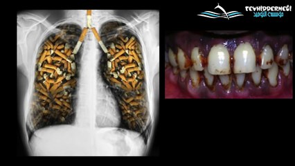 sigara habiys pisliktir kötüdür gatran siyah zehir kanserdir sigara haraem değildir diyen ke-efirdir