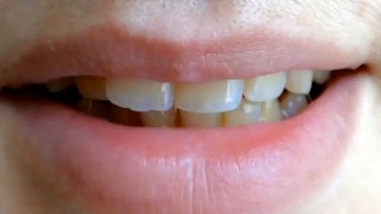 Mouth  falor companies hollywood