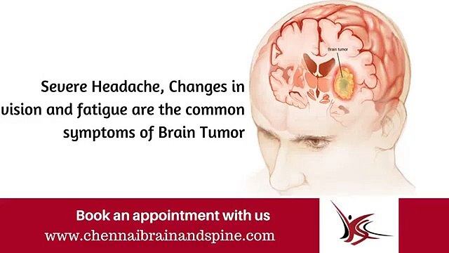 Brain Tumor Treatment in Chennai - Brain Tumor Symptoms - Brain Tumor Surgery in Tamil nadu, India