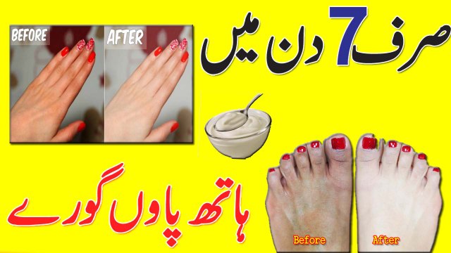 Whiten Hand Feet Remedy At Home || Skin Whitening Tips In Urdu Hindi Anam Home Remedy