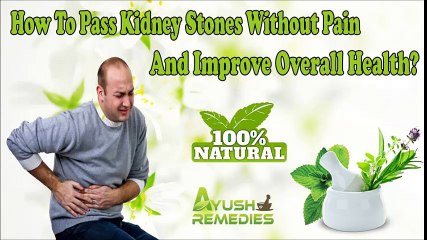 How To Pass Kidney Stones Without Pain And Improve Overall Health?