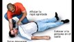 Cuidados para una persona que padece de convulsiones /first aid