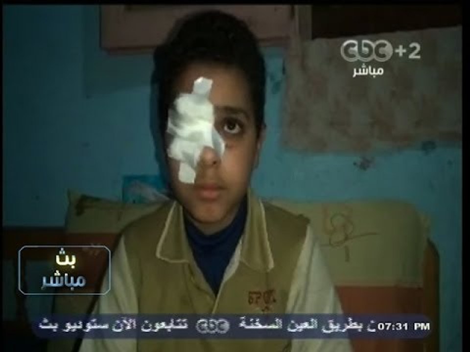#بث_مباشر| 29-11- 2013 | شيخ معهد يفقد طالب عينه بعد ضربه بـ "المقشة"