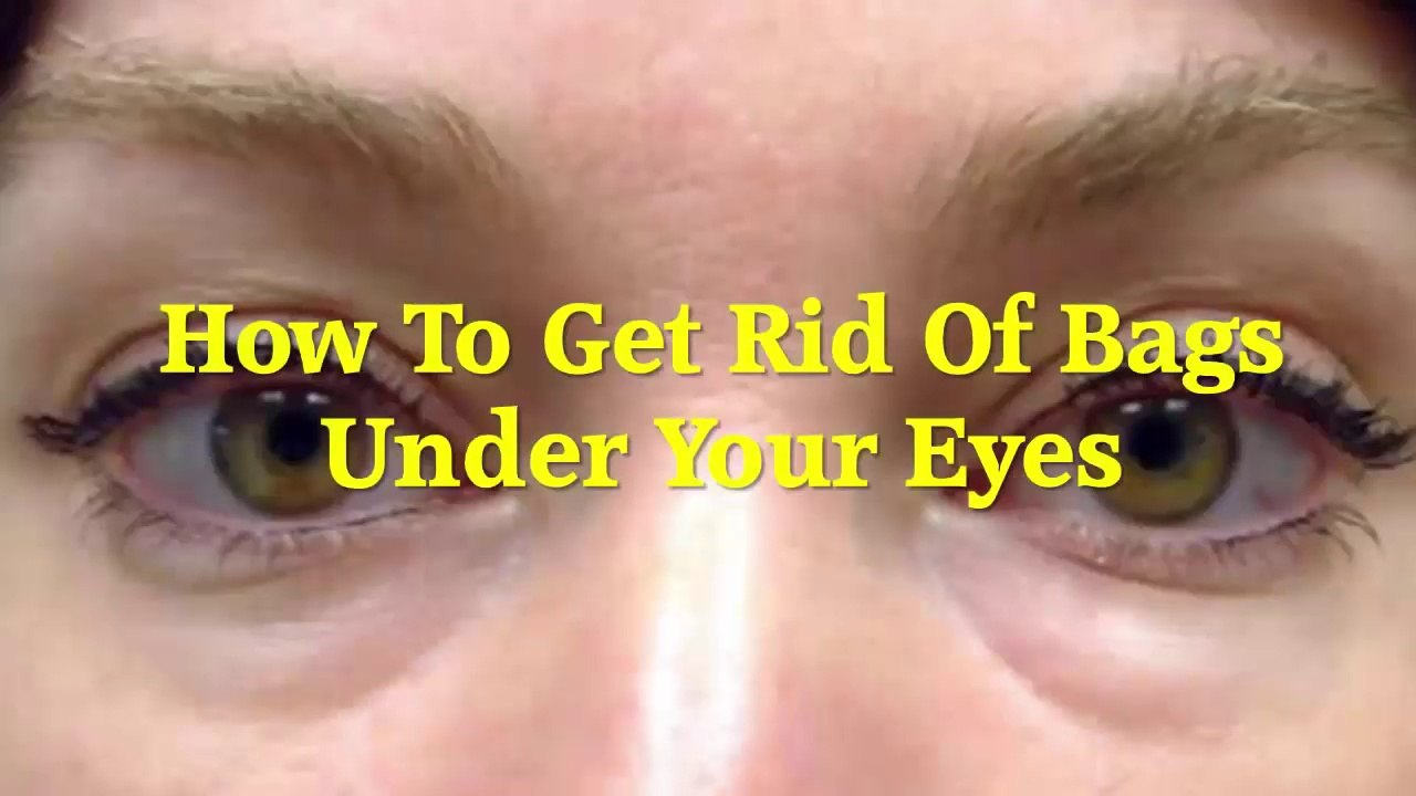 How to Get Rid of Bags Under your Eyes Fast - How to Get Rid of Eye Bags
