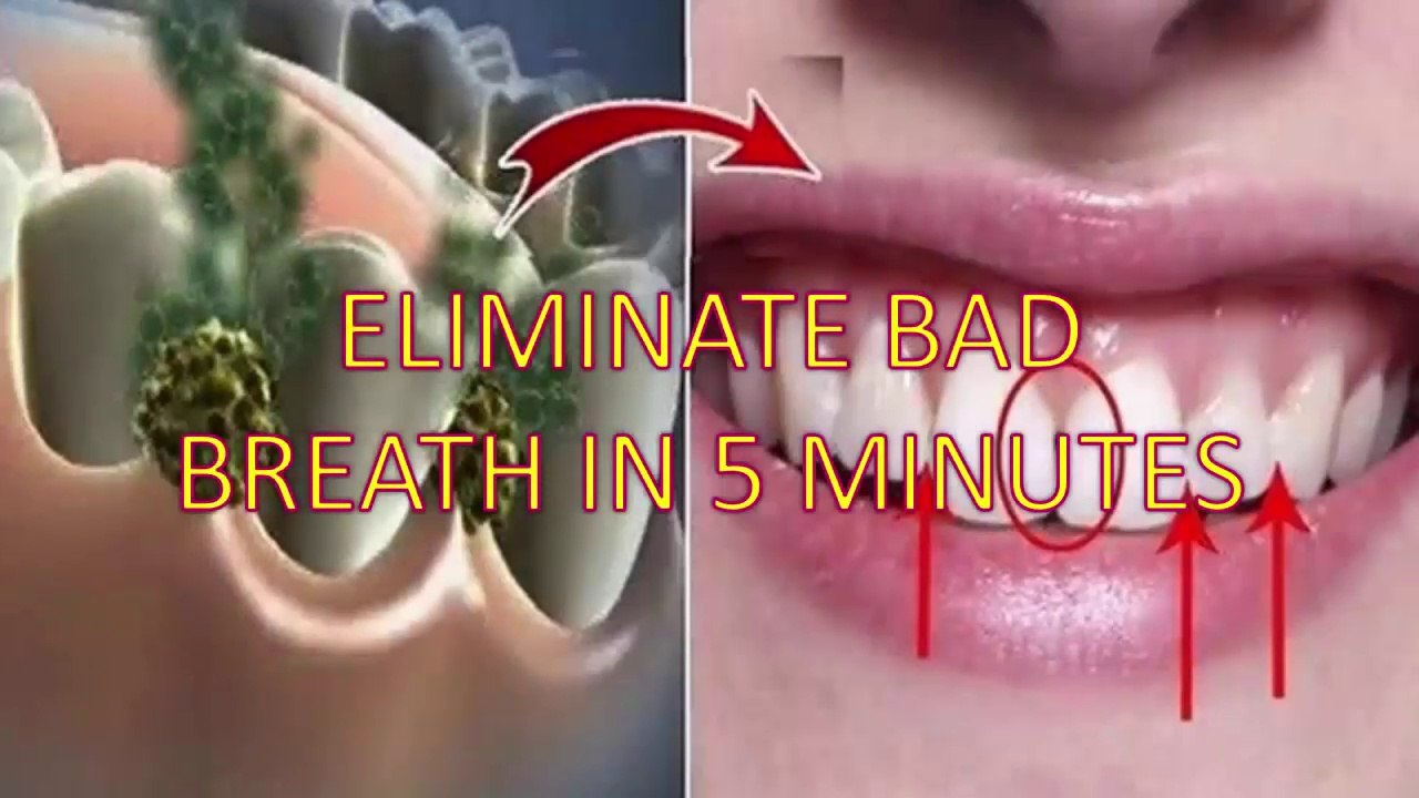 How to Cure Bad Breath Naturally Forever - Permanently Eliminate Bad Breath in 5 Minutes!