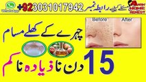 Remove Close Large Pores On Face Remedy